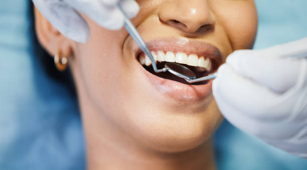 Best Emergency Dentist for Lost Fillings or Crowns in North Fond Du Lac, WI